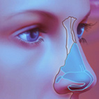 rhinoplasty